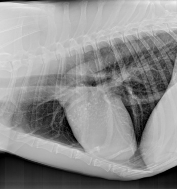 Osteosarcoma patient chest radiograph early in disease