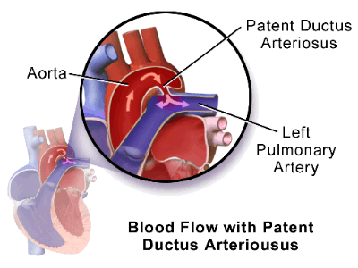  lung vasculature