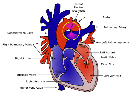 ductus arteriosus is shown in pink