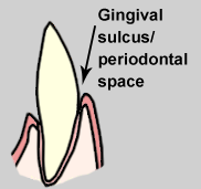 illustration of gingival sulcus illustration of gingival sulcus