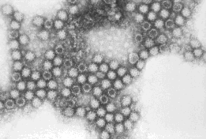 Electron micrograph of the feline calicivirus