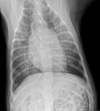 radiograph of post-treated pneumonia