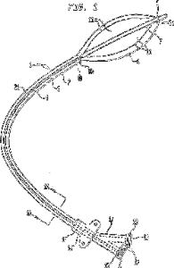 Balloon Valvuloplasty Device