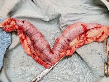 Pus-filled uterus after removal from a small dog