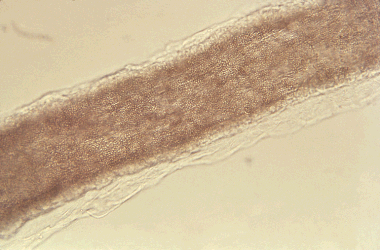 microscopic image of human hair swarmed by microsporum spores