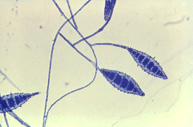 picture of cultured Microsporum canis under microscope