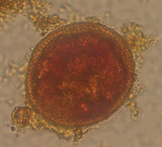 Toxocara egg