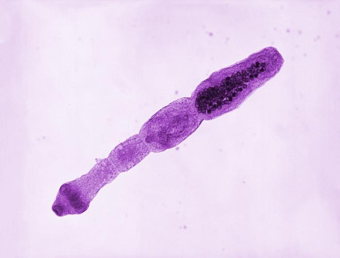 Echinococcus multilocularis tapeworm