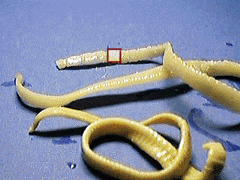 picture of Taenia tapeworm