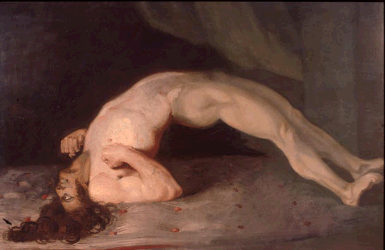 classical human posture with tetanus classical human posture with tetanus