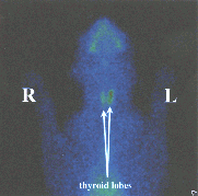 Scan of cat with normal thyroid glands