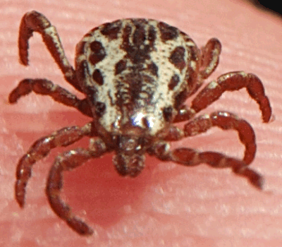  American Dog Tick (Dermacentor variabilis)