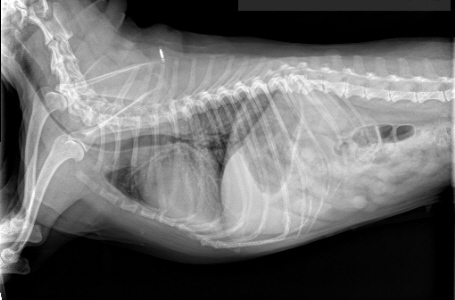 Same patient six months later after a cough had developed.