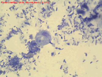 Direct smear showing Tritrichomonas organisms.