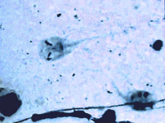 Giardia organism