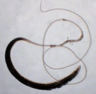 Image of an Adult Whipworm