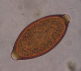Image of Whipworm egg isolated from a stool sample. 